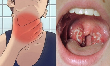 Tuyên truyền về phòng chống bệnh bạch hầu